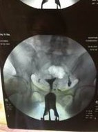 长春哪家医院能助孕生孩子？最新上线长春助孕三代试管助孕医院大全